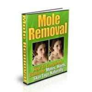 Mole Removal
