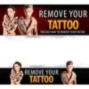 Tattoo Removal Template